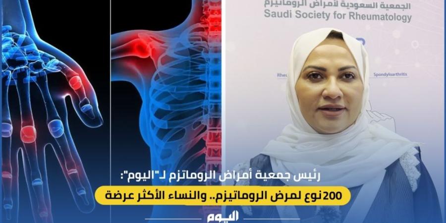 رئيس جمعية أمراض الروماتزم لـ”اليوم”: للمرض 200 نوع.. والنساء أكثر إصابة - وكالة Mea News